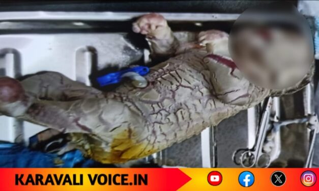 ಭಯಾನಕ ರೂಪದ ಹೆಣ್ಣು ಶಿಶು ಜನನ: ಮಣಿಪಾಲಕ್ಕೆ ರವಾನೆ