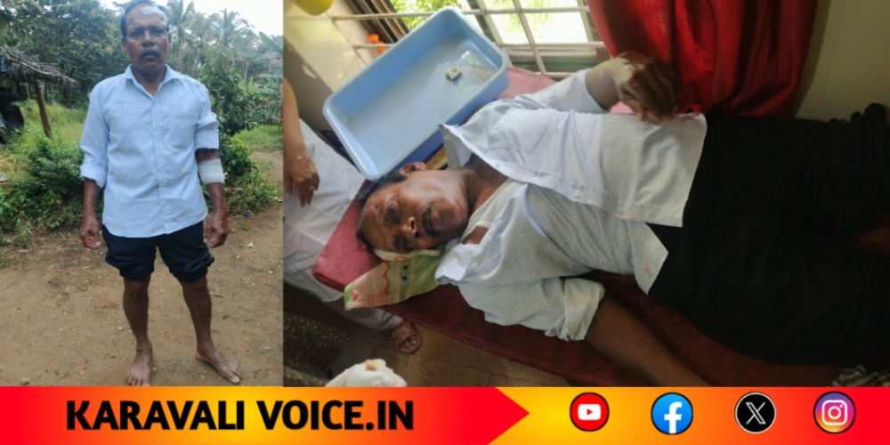 ಮತ್ತೆ ಹೋರಿ ಅಟ್ಯಾಕ್; ಸ್ಕೂಟಿ ಸವಾರನಿಗೆ ಗಂಭೀರ ಗಾಯ!